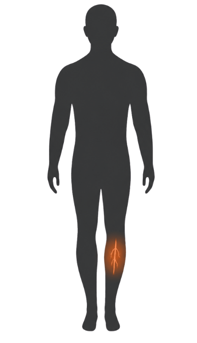 Silhouette of a person with an orange highlight on the calf, showing a branching vein pattern on the lower leg, indicating possible vein-related issues.